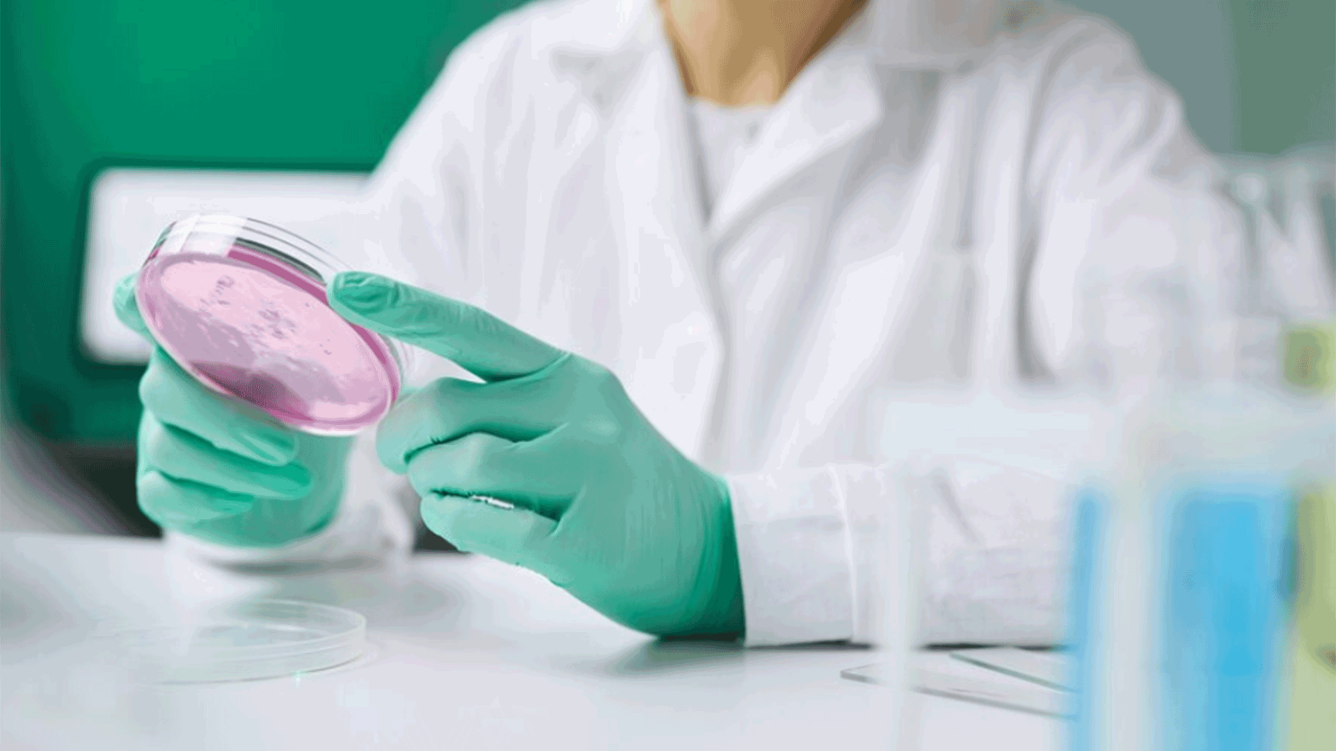 doctor examining samples for women with pcos