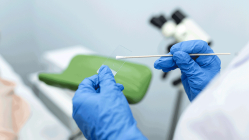 Doctor getting sample of pap smear test