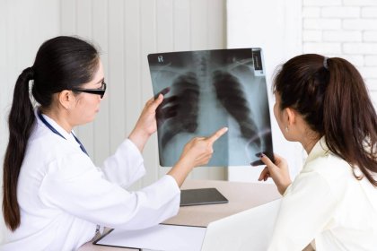 When to Consider Imaging Tests for Lung Cancer Detection